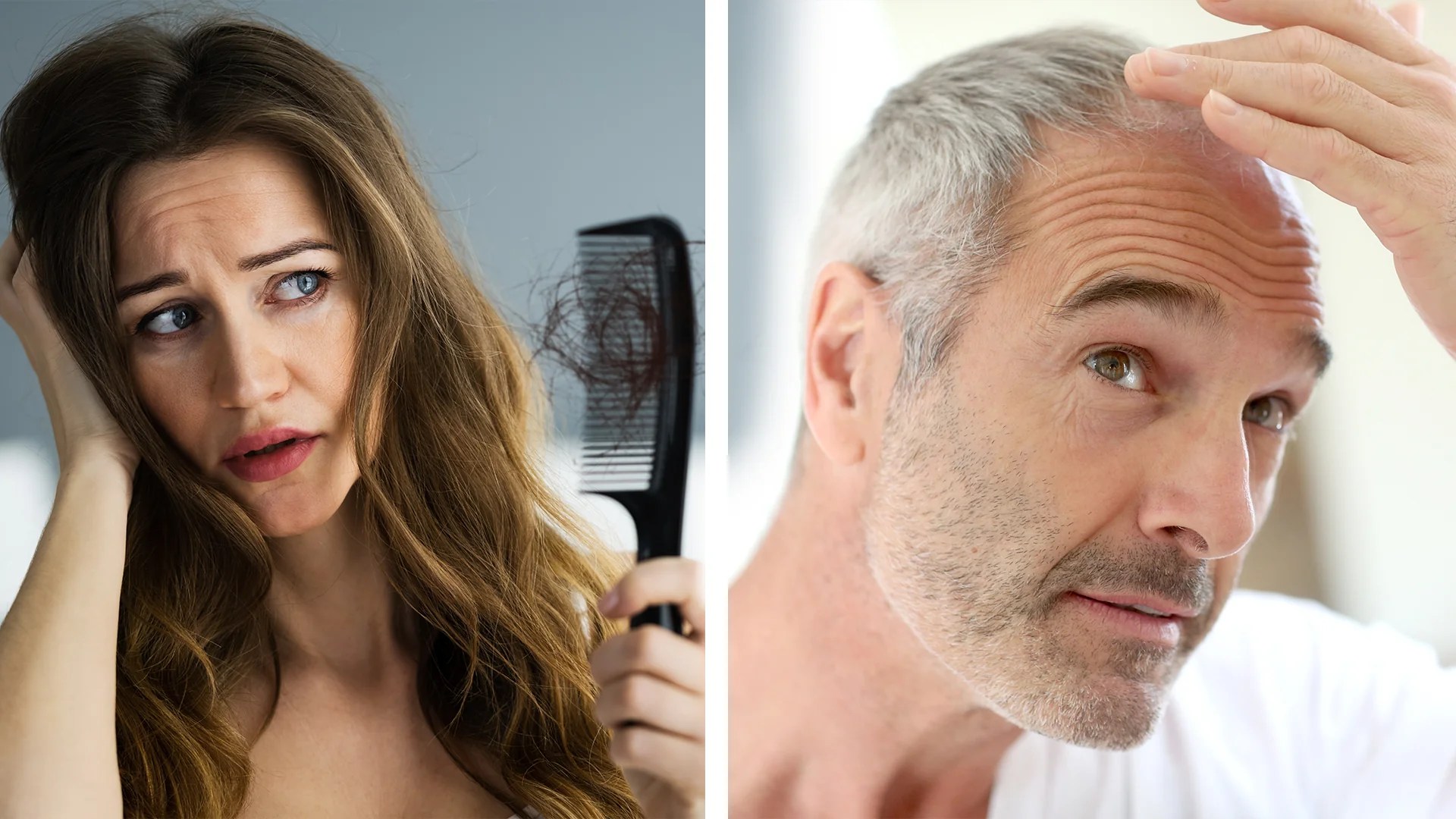 Specialist Hair Loss Clinic Birmingham Dynamic Regenerative Medicine