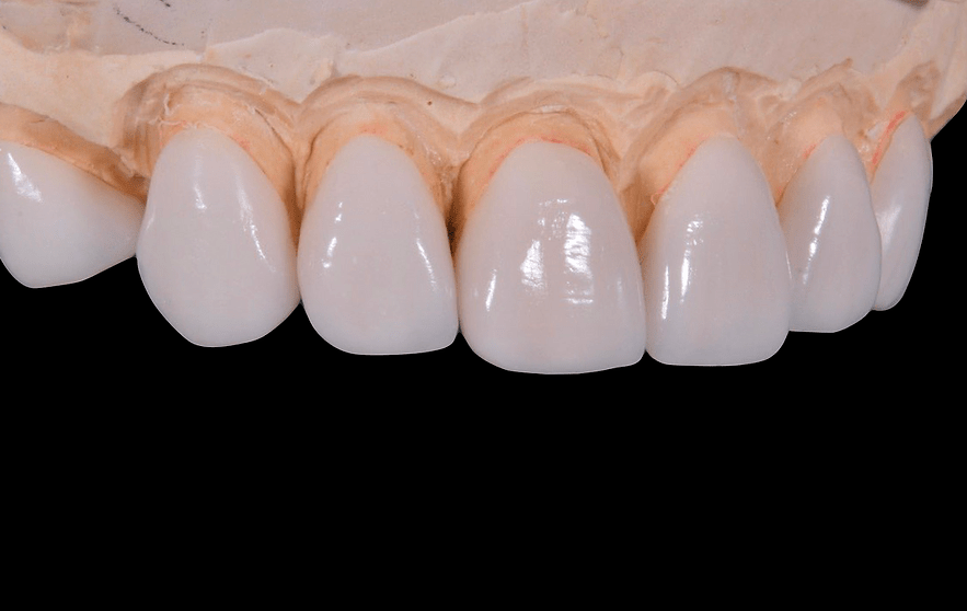 Quek And Me Dental Surgery Laminate / All Ceramic