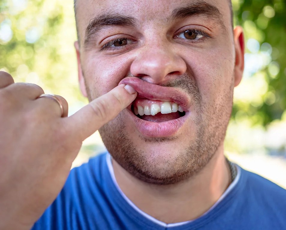 Transform Your Smile with Cosmetic Dentistry Veneers, Crowns, Bonding