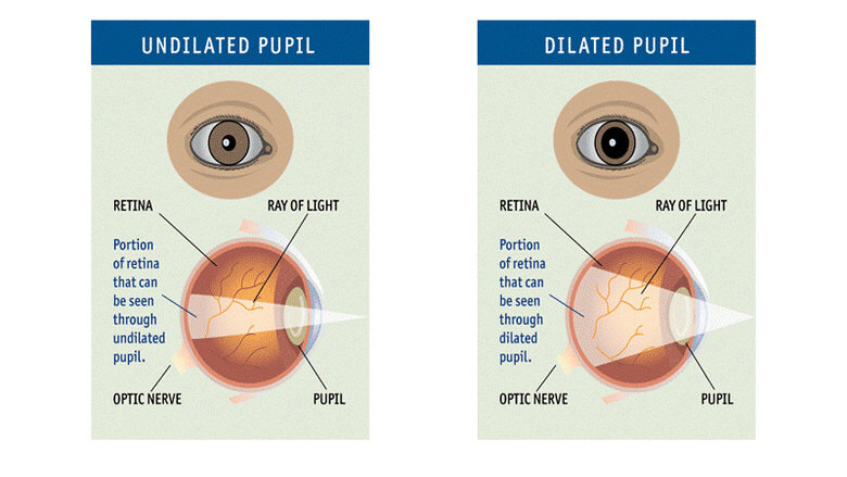 Pupil size chart normal - consumervery