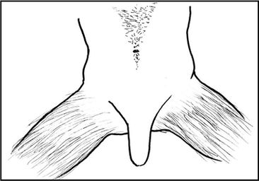épilation masculine images
