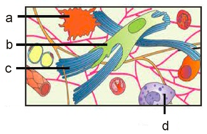 In the given sketch of connective tissue, identify the type of