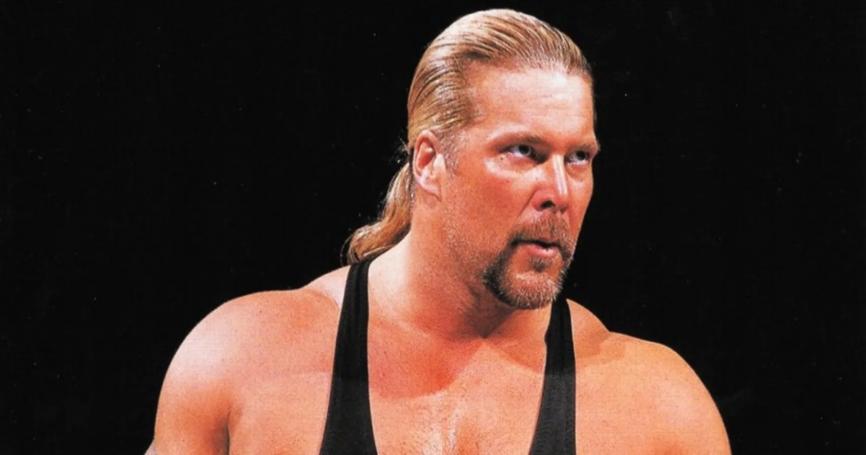 Kevin Nash Shows Off Nasty Photos From Recent Surgery