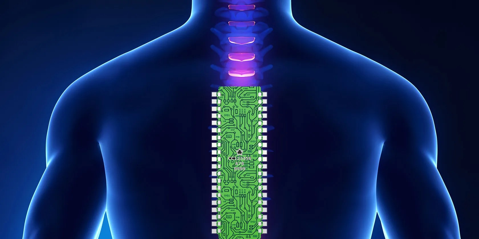 Researchers Show How Computers May One Day Bypass the Spinal Cord