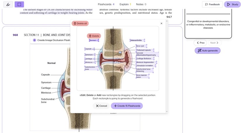 Creating an image occlusion flashcard with FlashKa