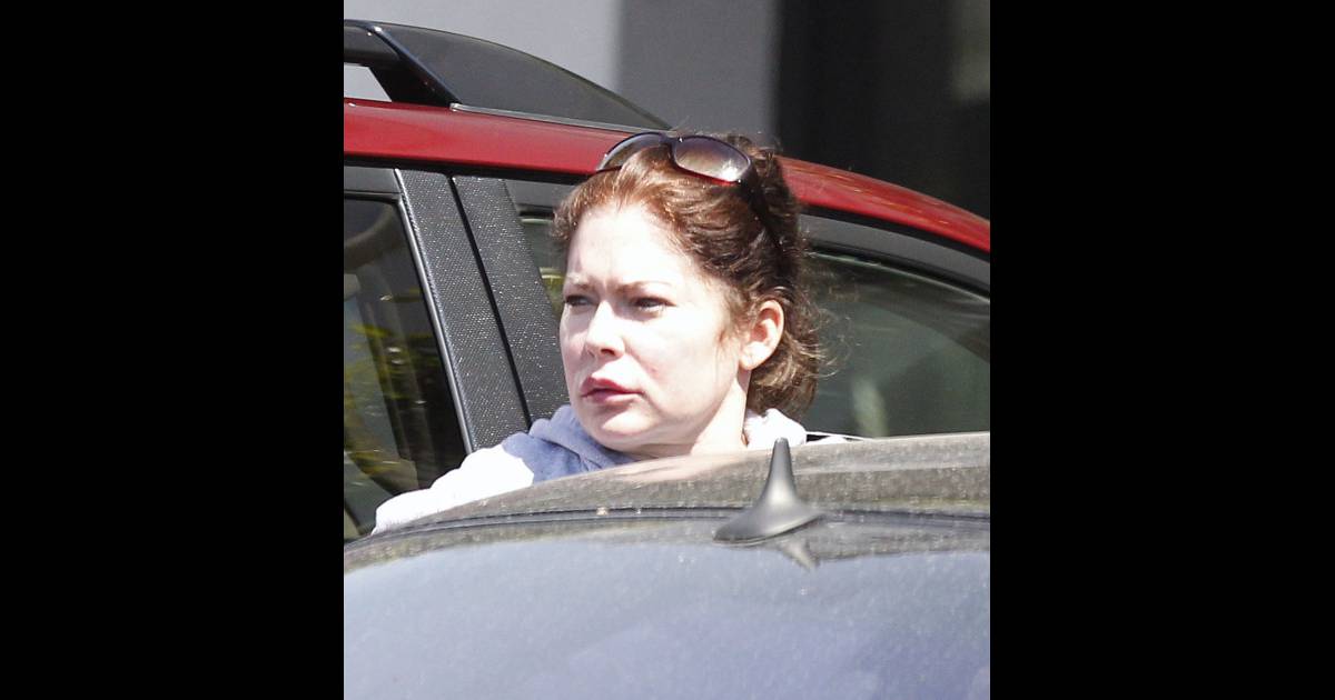 L'actrice Lara Flynn Boyle, défigurée par la chirurgie