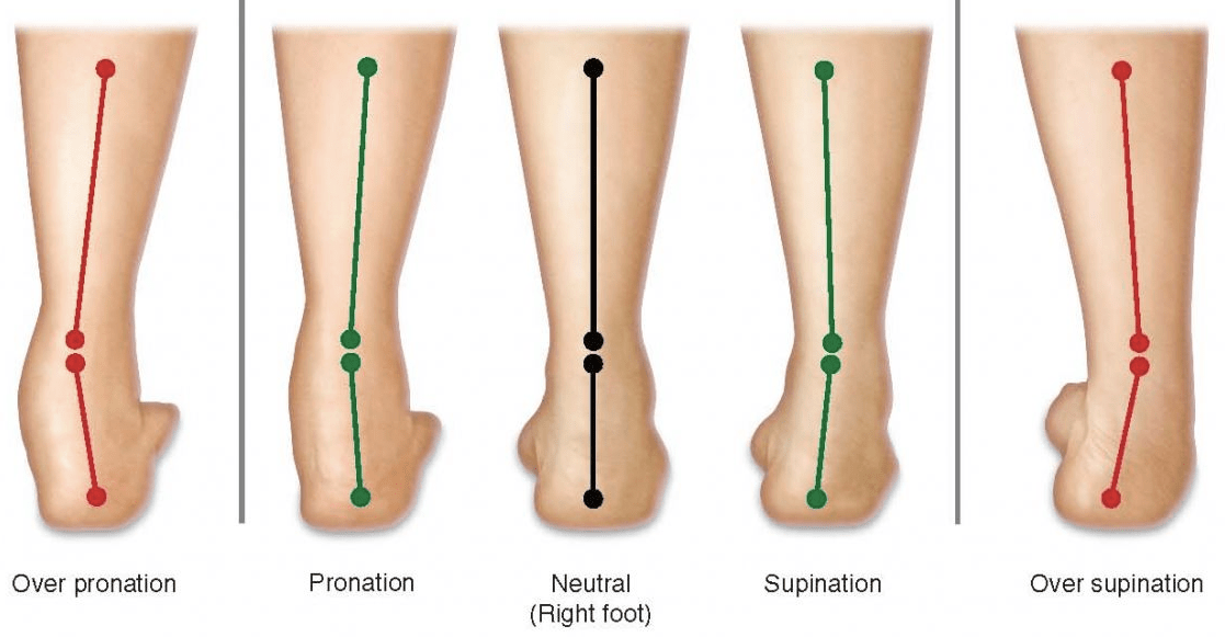 Calf Muscle Tightness, Achilles Tendon Length and Lower Leg Injury