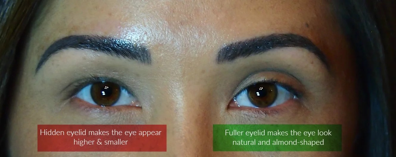 Advanced Technique Making Uneven Eyes Look Symmetrical — Dela