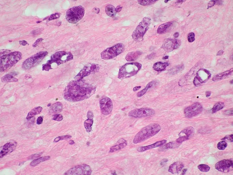 Frozen Section Technique IV — Pathology Innovations
