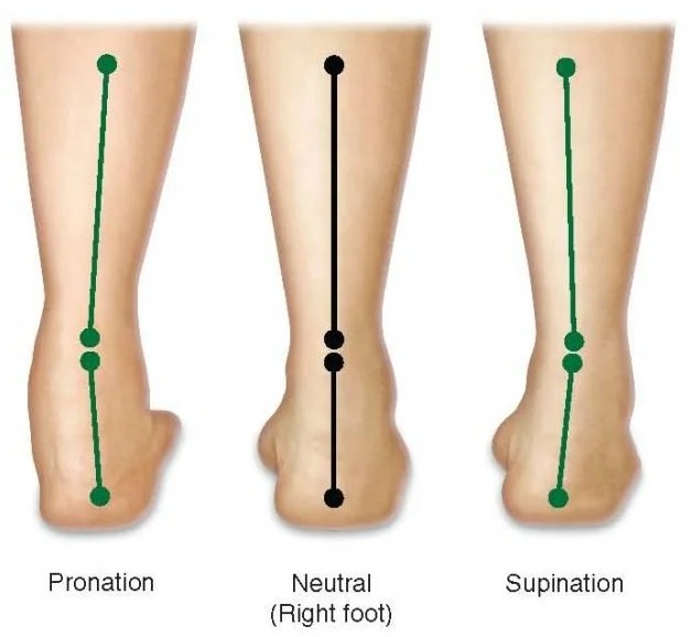 Pioneer Podiatry Flat Feet, Collapsing Arches, OverPronation & High