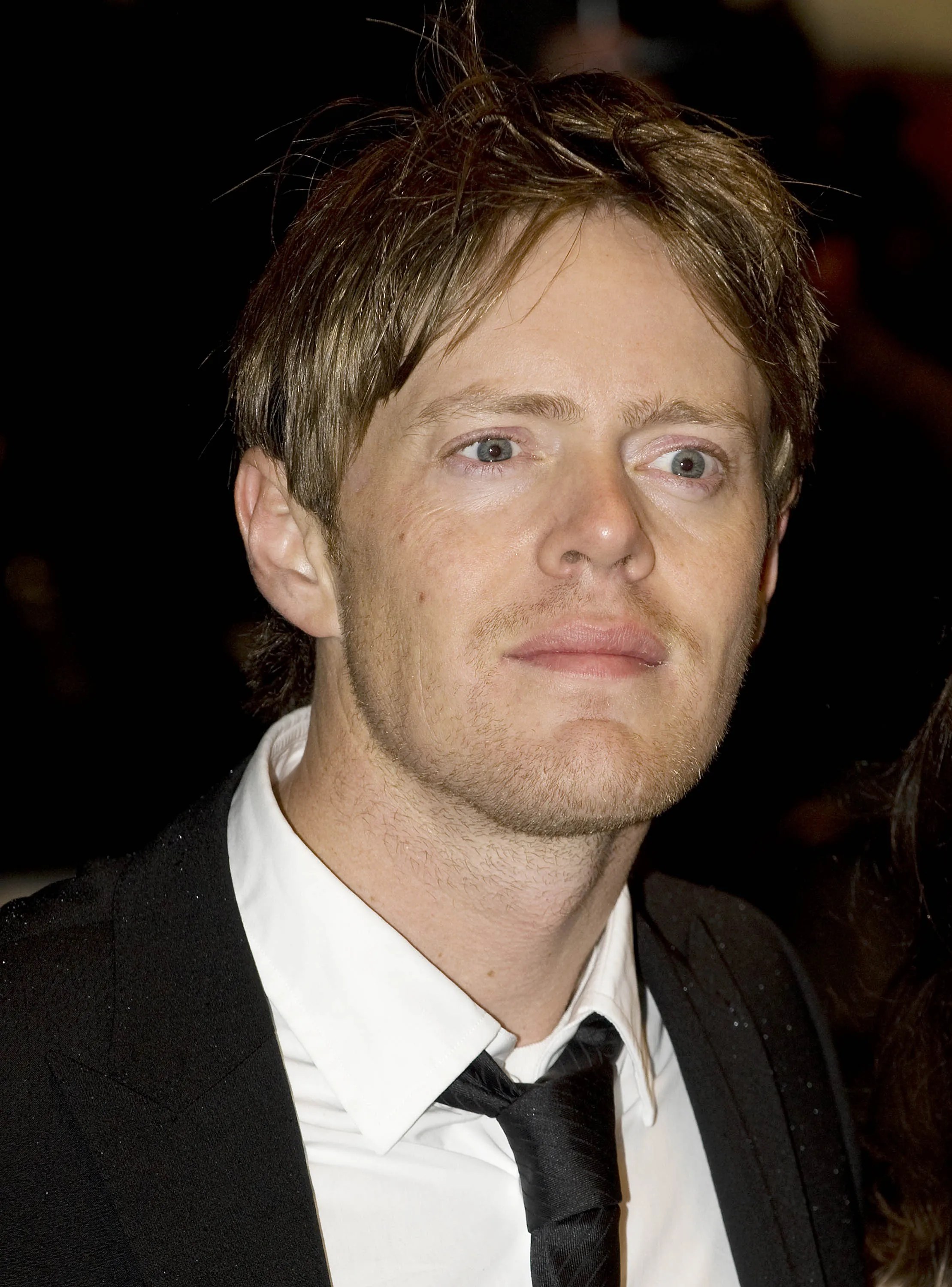Kris Marshall Face Surgery What People Are Saying