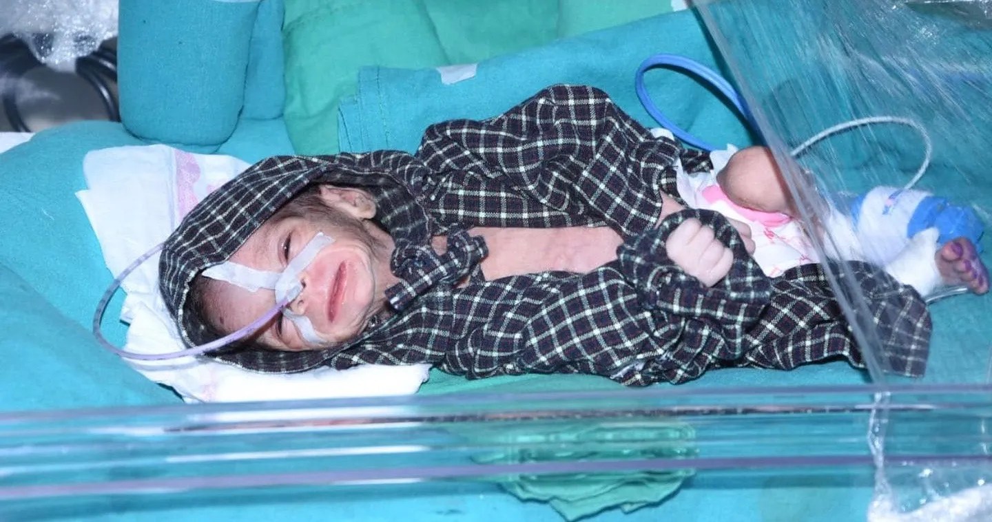 Baby Found Buried Alive In A Clay Pot BabyGaga