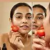 Tomato and turmeric won’t cure acne—experts reveal shocking truth