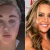 ‘Keeps getting worse’ Fans worry as Amanda Bynes adds lip injections