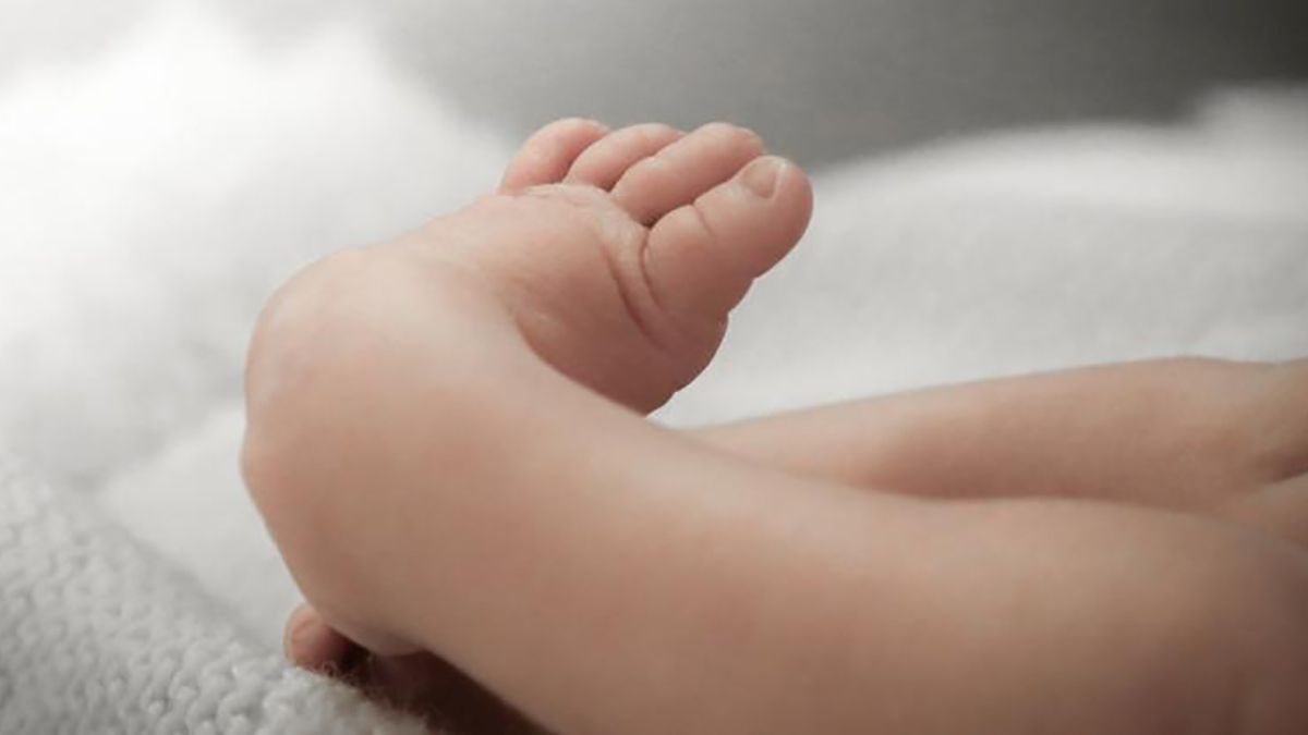 Pies zambos síntomas, causas, tratamientos e información