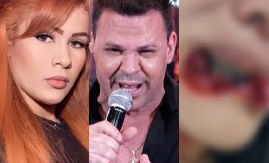 Exaffair de Eduardo Costa ataca mulher e arranca o lábio