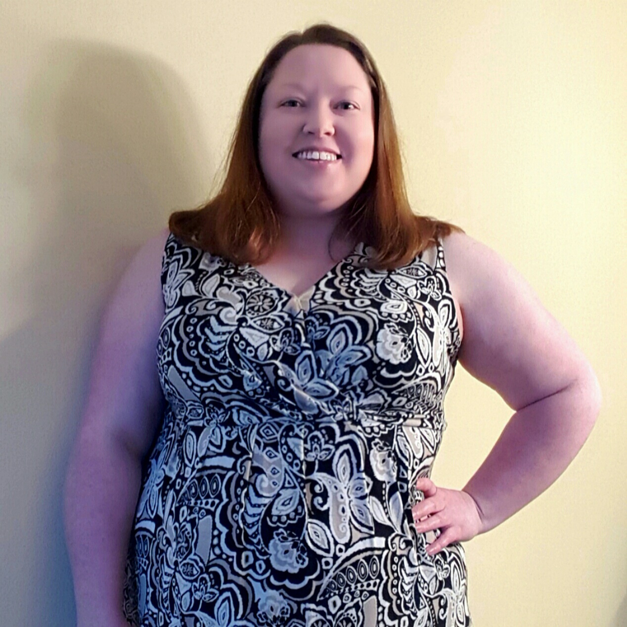 Theresa Jensen of San Diego, California Genital Herpes