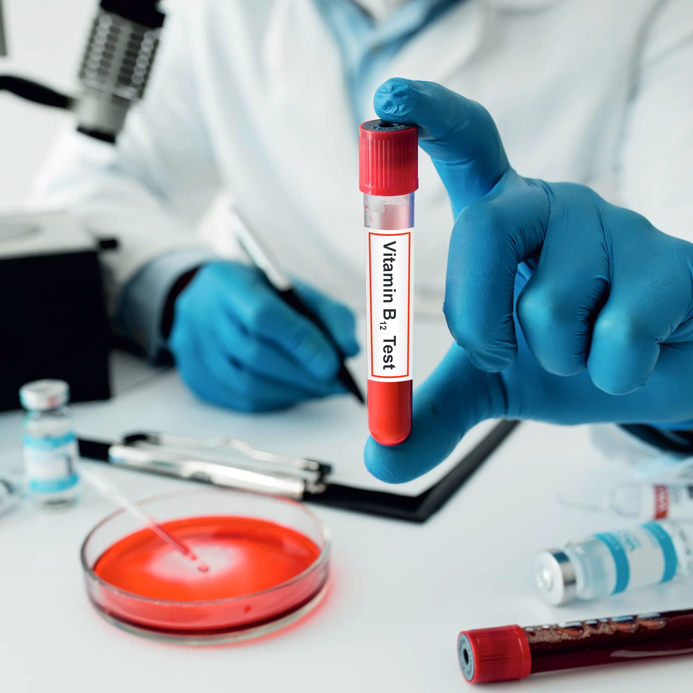Vitamin B12 Test Why Its More Important Than You Think Diagnostics