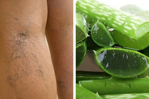 Du kan ha gastroesofageal reflux utan att veta om det Steg för Hälsa