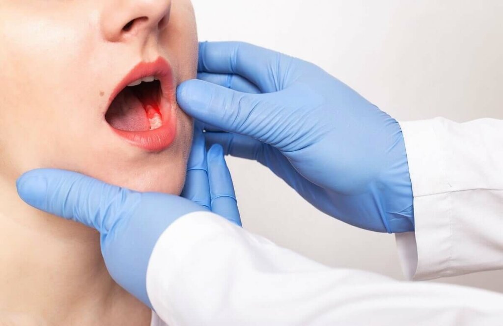 Periodontit En problematisk sjukdom i tandköttet Steg för Hälsa