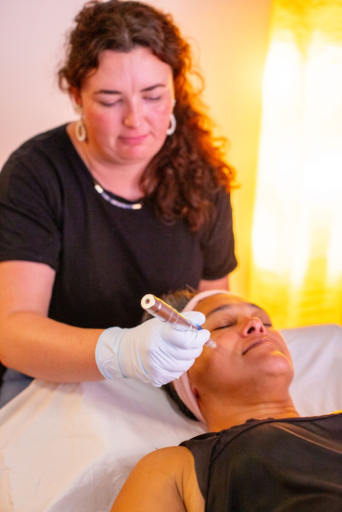 Microneedling Stella Luna Therapy