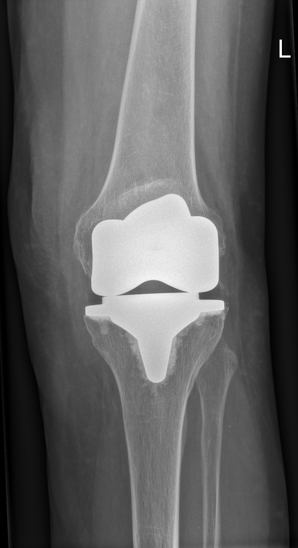 Kniegelenk Priv.Doz. Dr. David Stelzeneder
