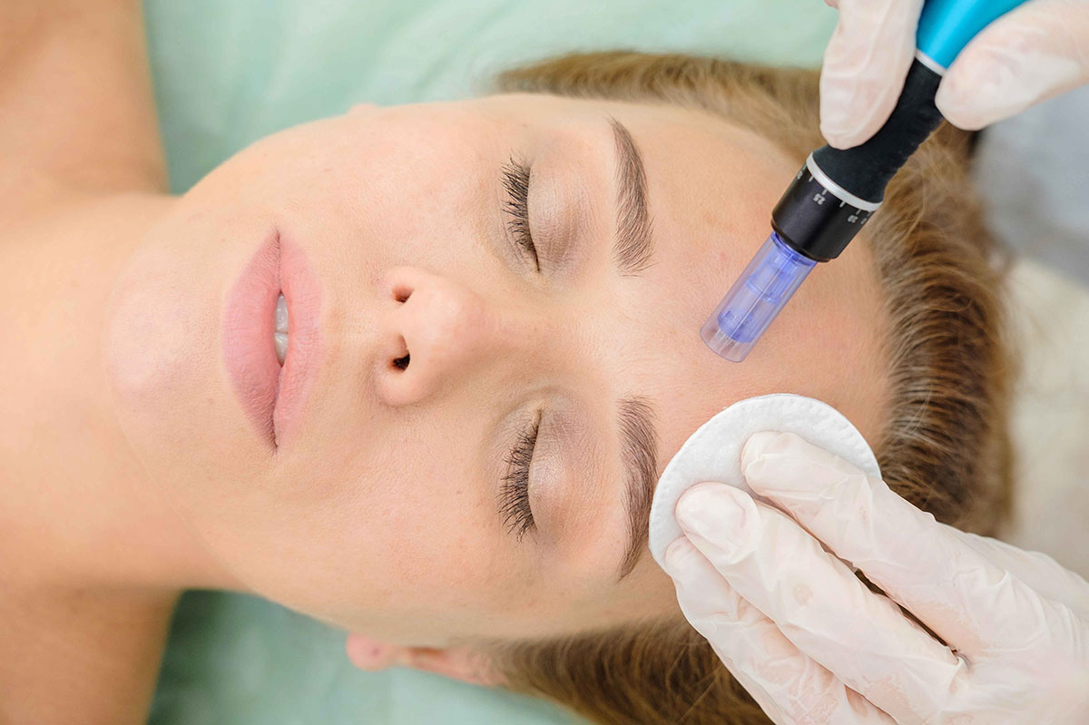The NonInvasive Face Lift How Stem Cell Treatment is Changing the Game