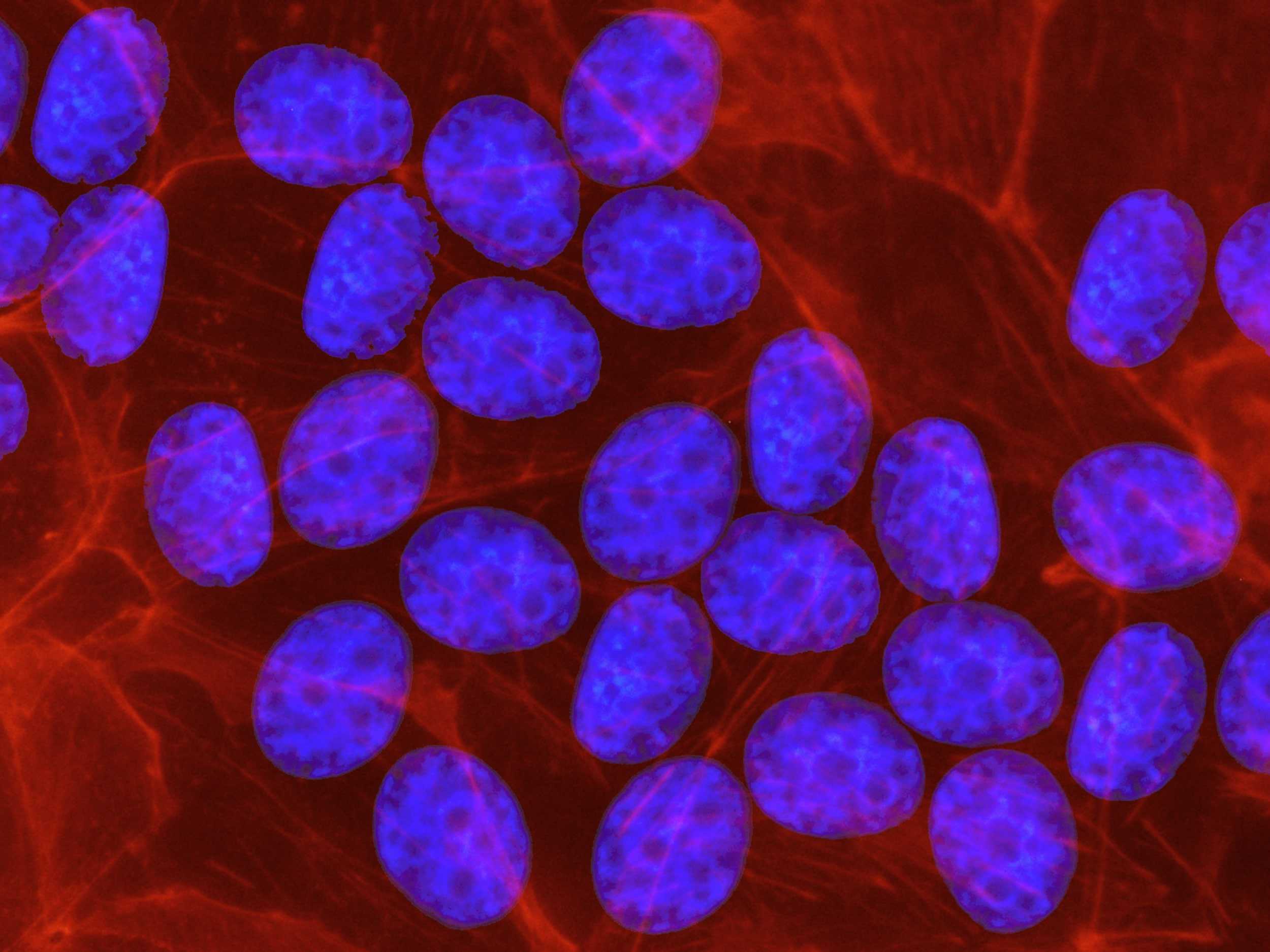 Stem Cell Therapy Pros and Cons Dynamic Stem Cell Therapy