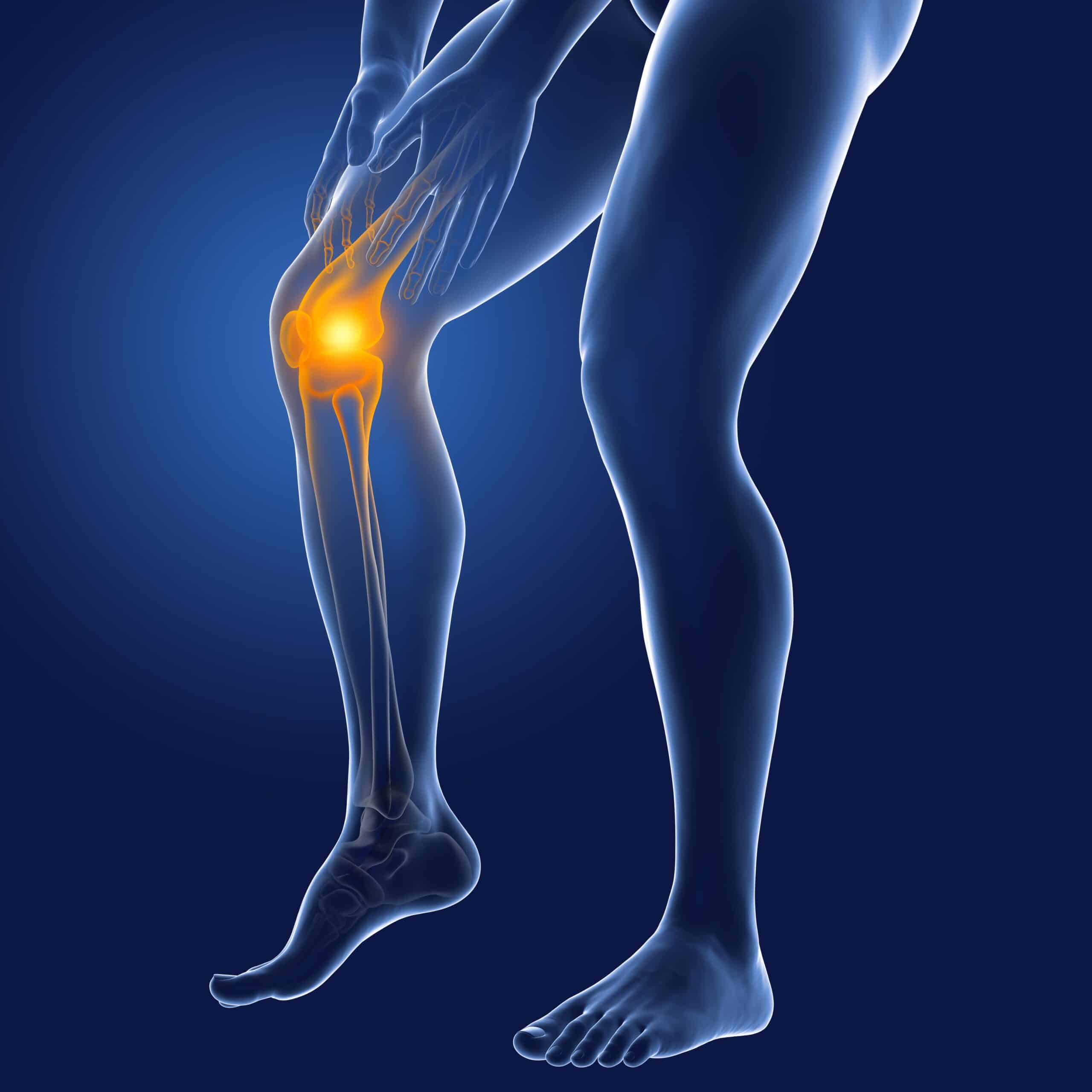 Alternative Treatments For Meniscus Tear Dynamic Stem Cell Therapy