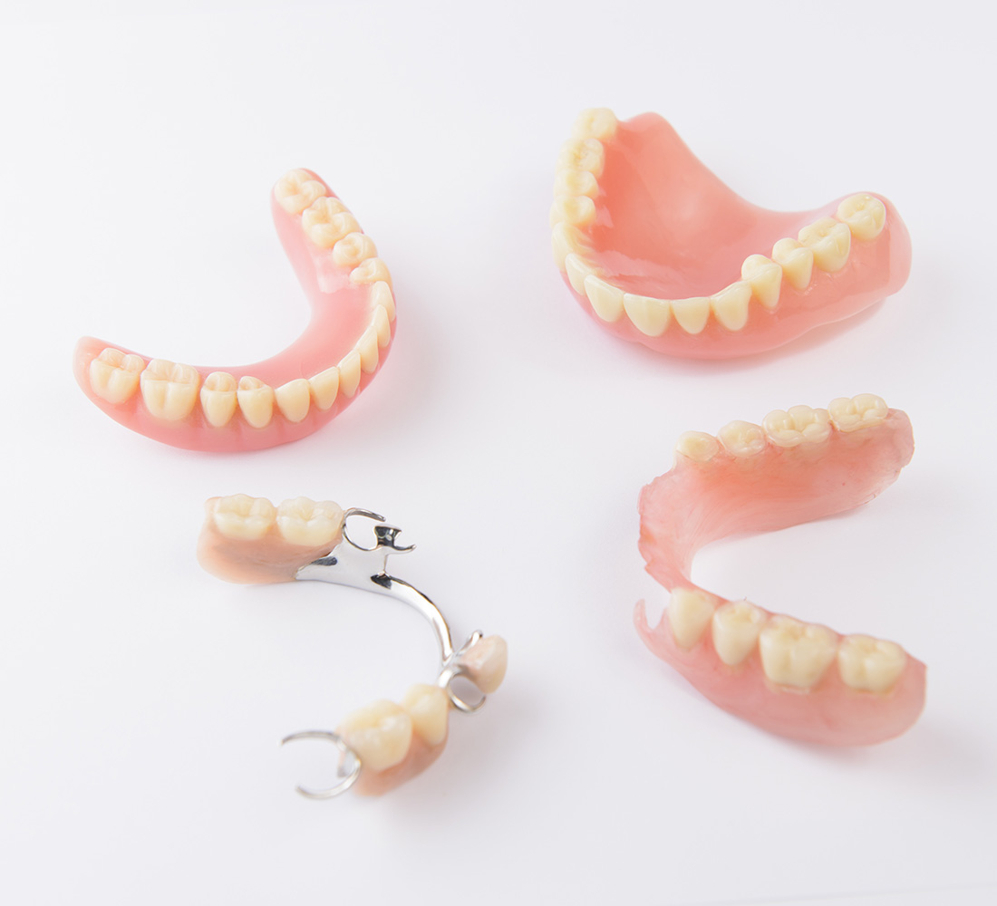 Dr. Spelman Las Vegas Dental Crowns Dental Bridges In Summerlin