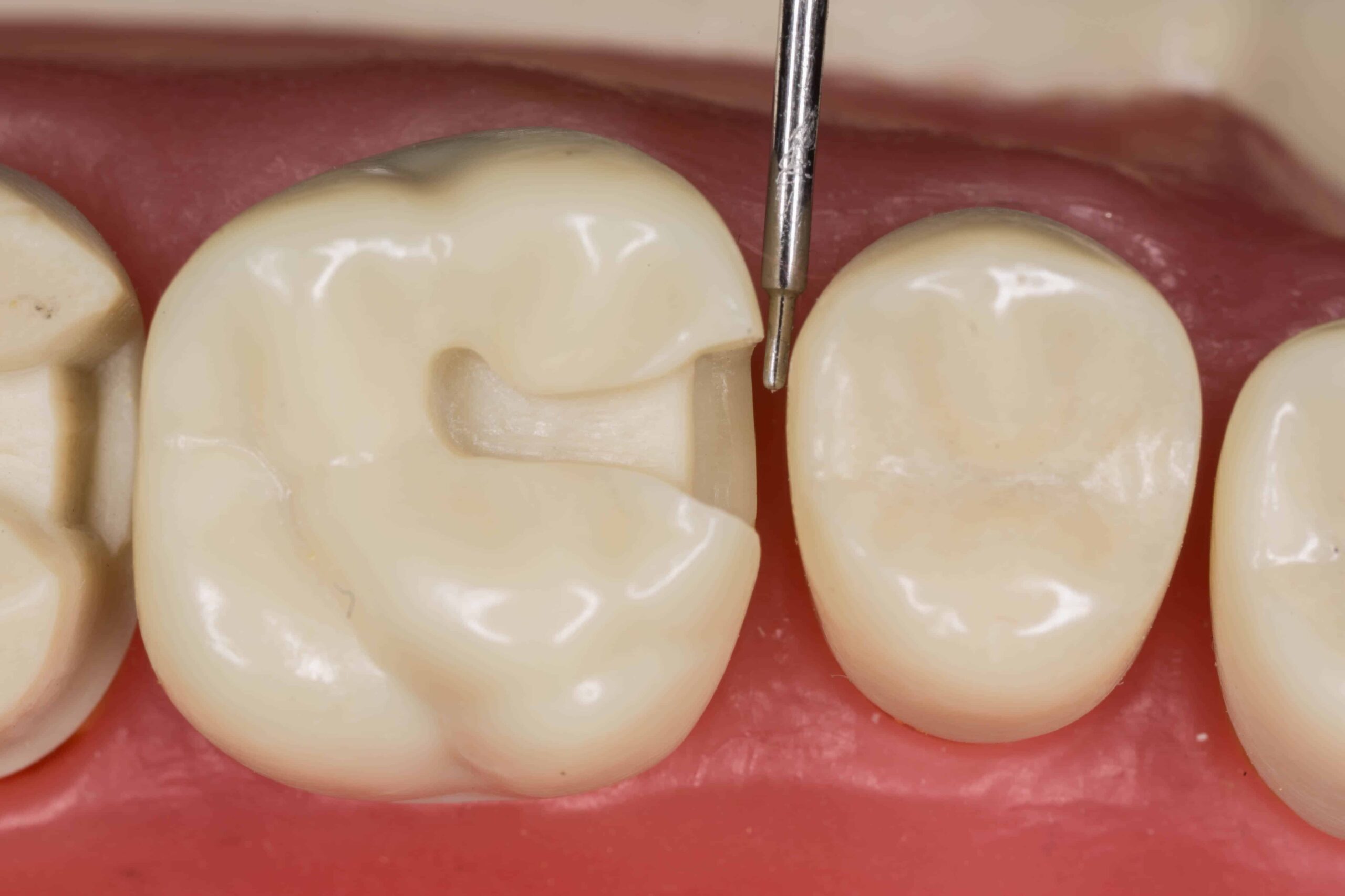 Stevenson Dental Bench Prep System
