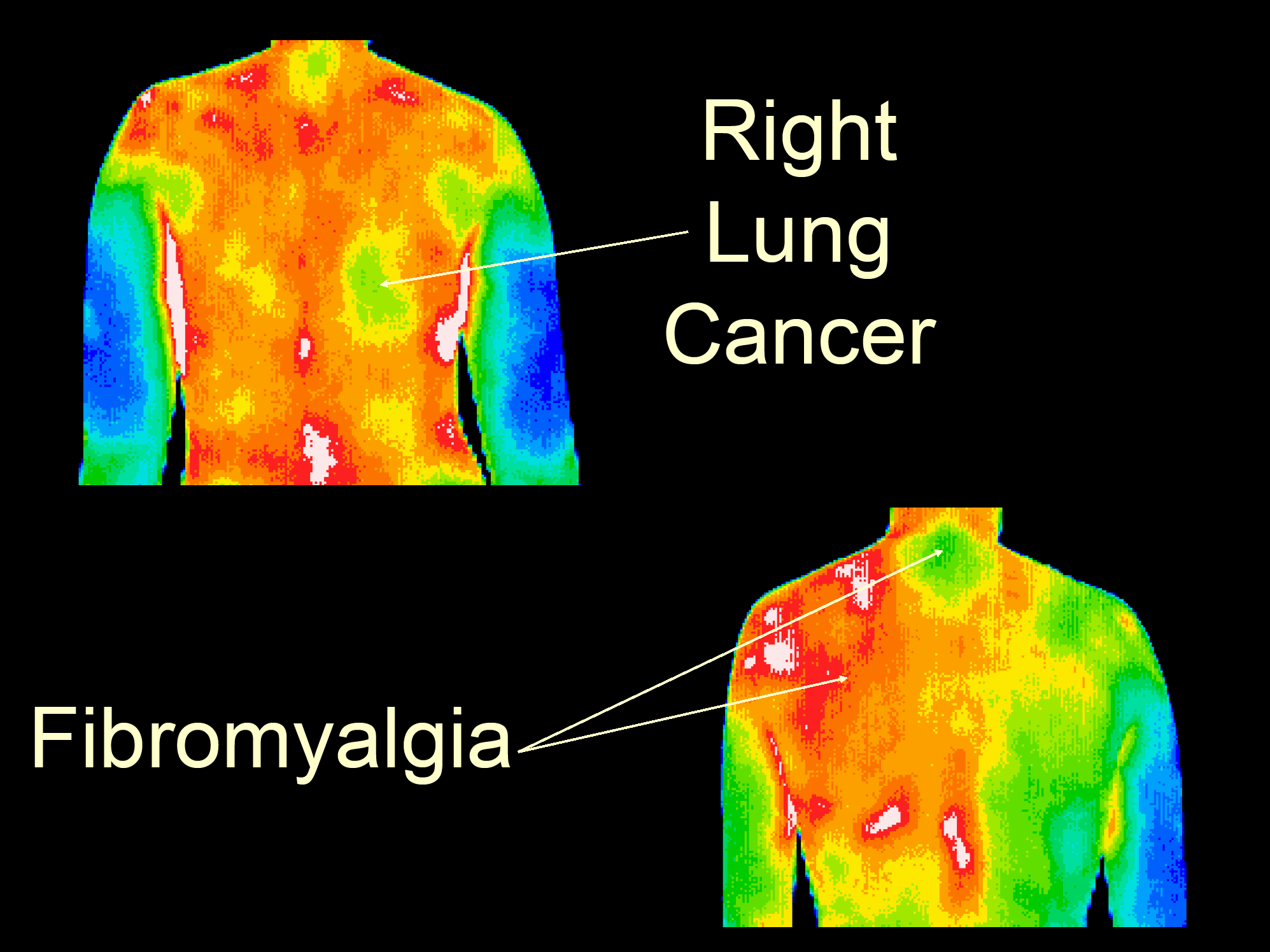 Full Body Imaging » Medical Thermography
