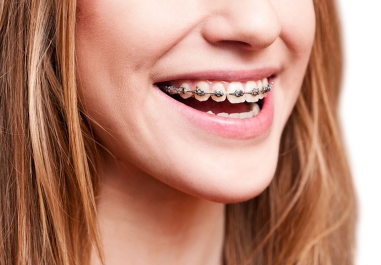 Stoke Orthodontics Highest Standard Of Orthodontic Care