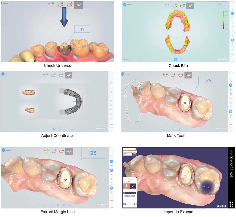 Aoralscan Stomadent Dental Lab