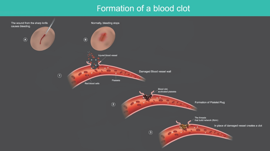 Blood Clot Curcumin Treatment Is Turmeric a Natural Blood Thinner? 1MD