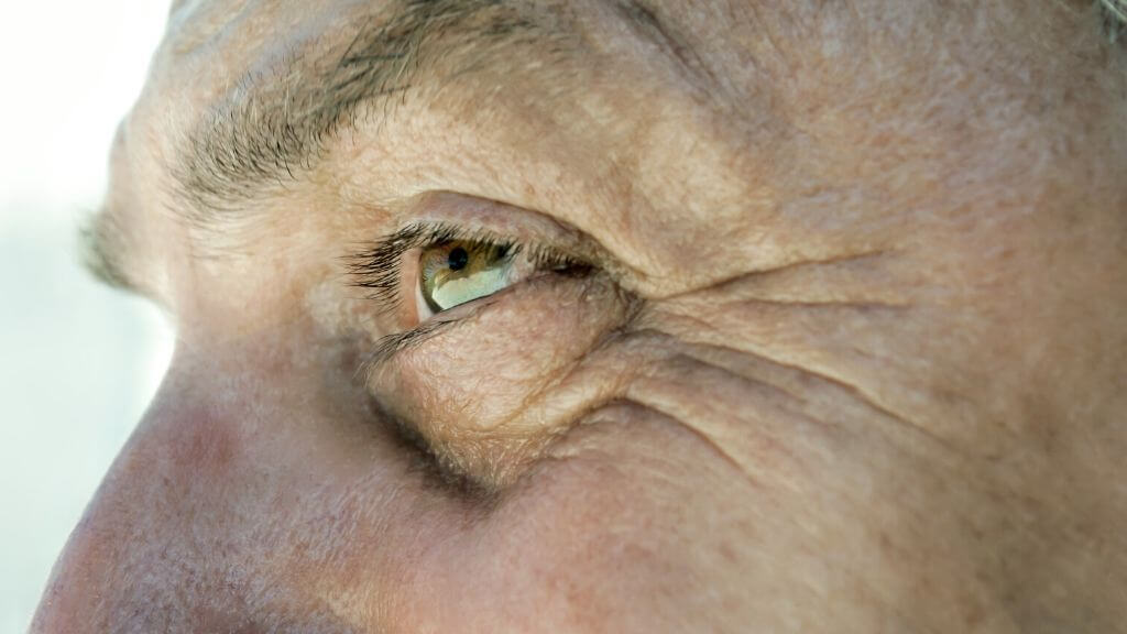 Curcumin For Eye Treatment A Potentially Effective Cataract Therapy 1MD