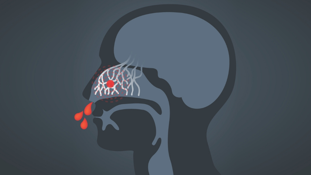 The Side Effects of Krill Oil You Should Know Before Starting