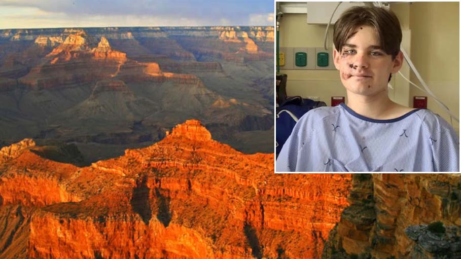 13 Year Old Boy Falls 100 Feet at Grand Canyon And Miraculously Survives