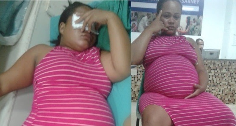 Grávida perde bebê após levar susto com tiros que mataram funcionários