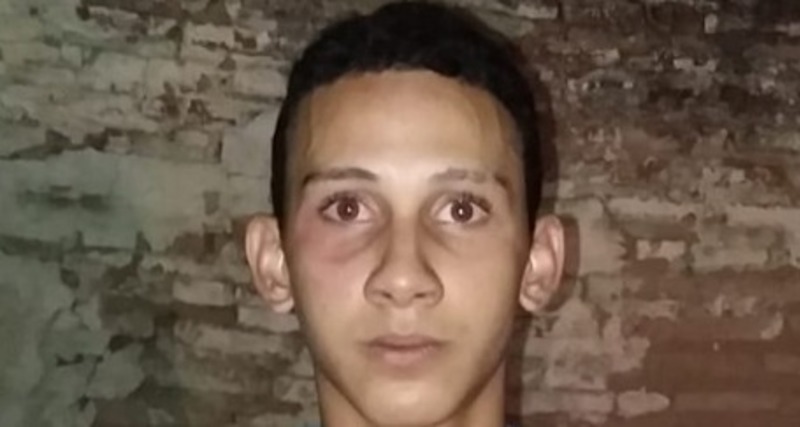Mulher tem 80 do corpo queimado e perde seio por conta de tatuagem Polícia prende principal acusado de matar jovem de 16 anos de idade