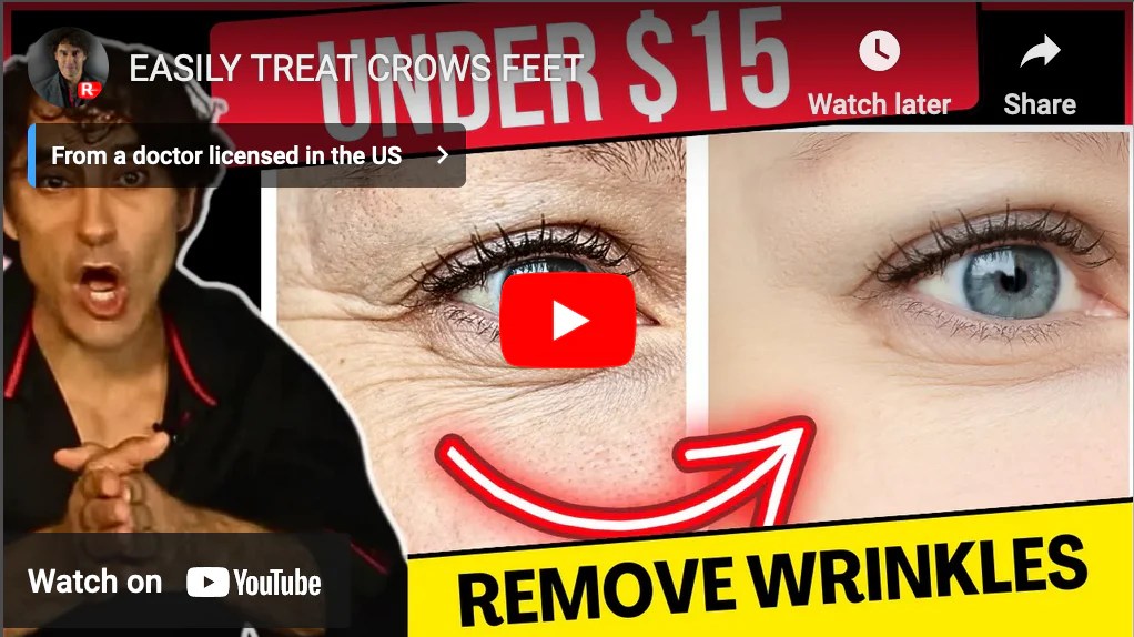 EASILY TREAT CROWS FEET