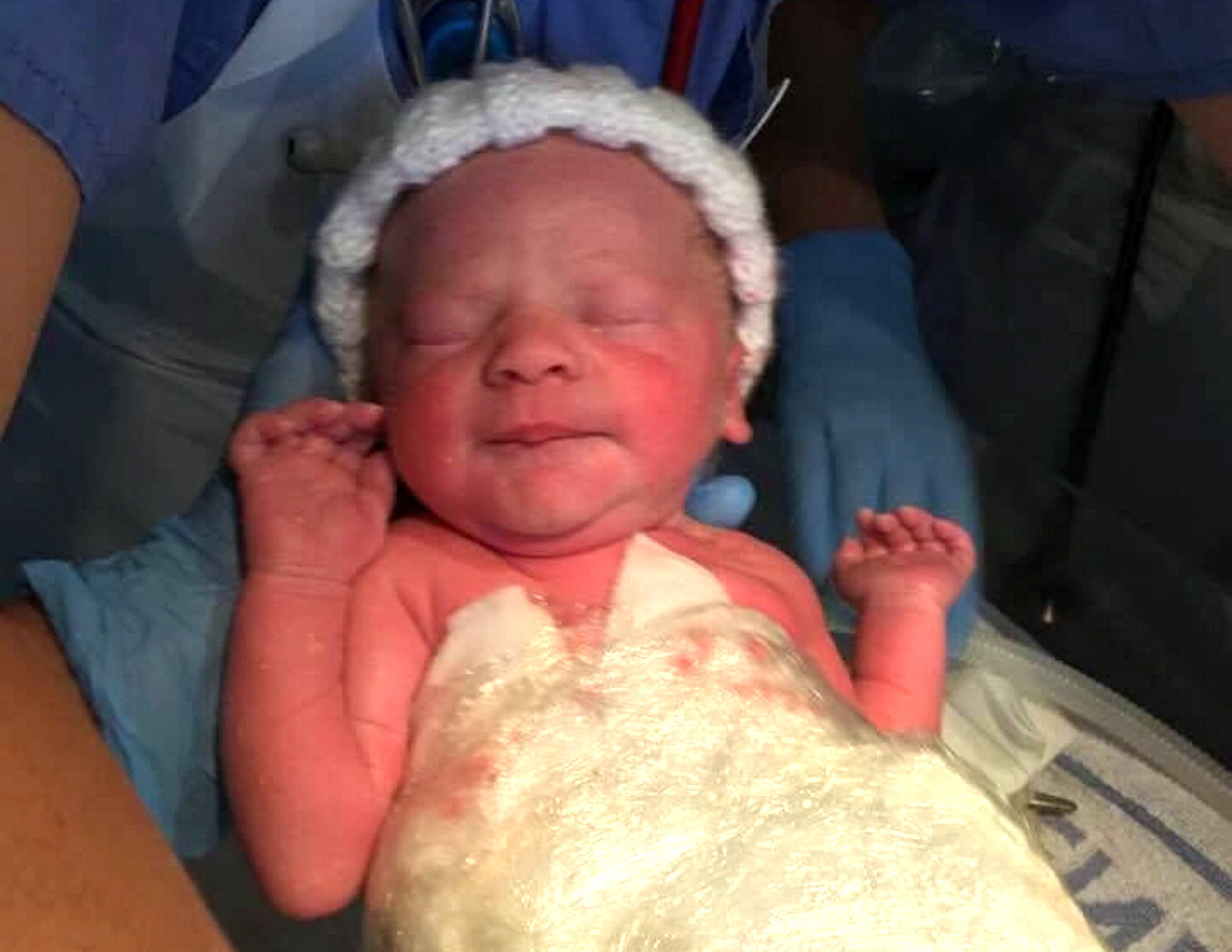 Baby Born With Organs Outside Her Body Saved After Being Wrapped In CLINGFILM SWNS