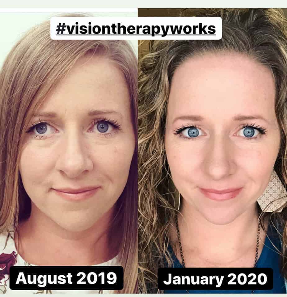 to Strabismus Solutions Strabismus Solutions