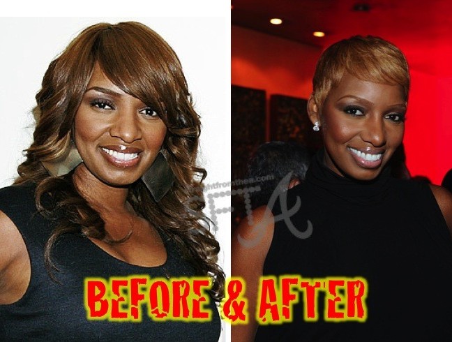 Before & After: NeNe Leakes Admits to Plastic Surgery + NeNe 2.0