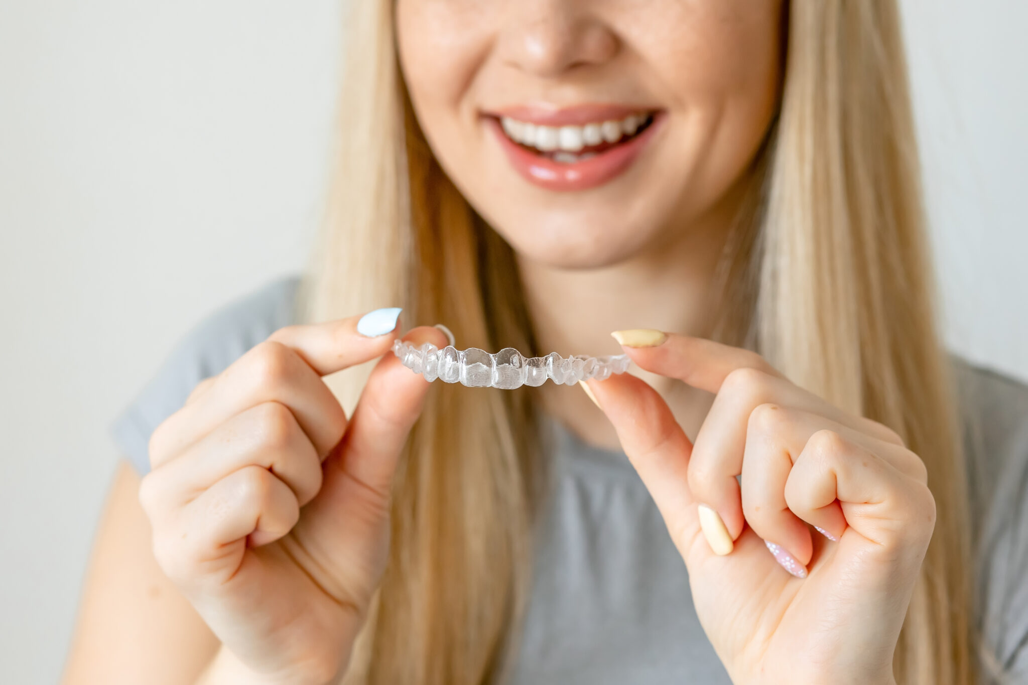 What To Expect From Clear Aligners Prairie Village, KS
