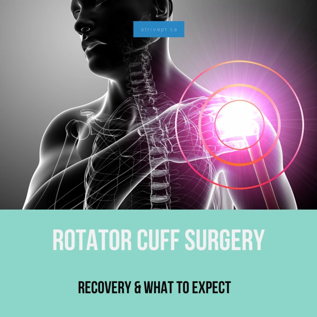 Rotator Cuff Surgery and Recovery Shoulder Surgery