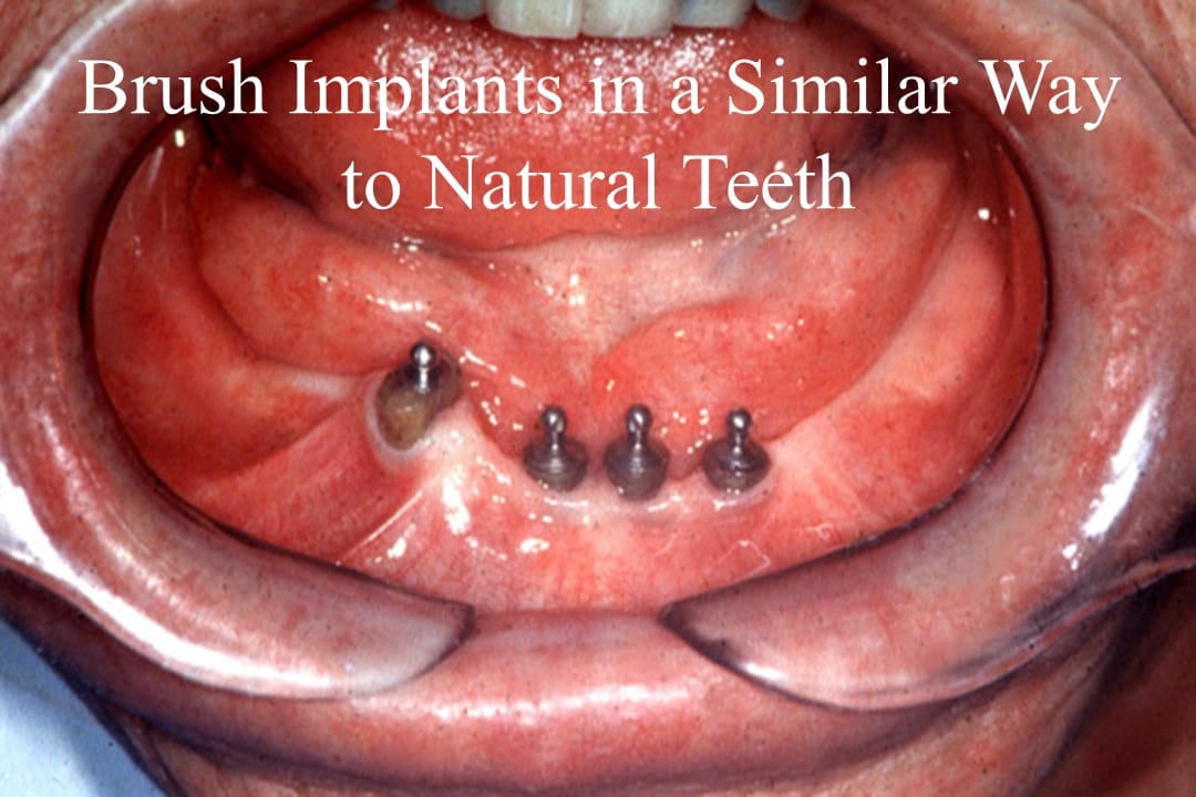 Dental Health Courses & Lectures Dental Health in Implantology