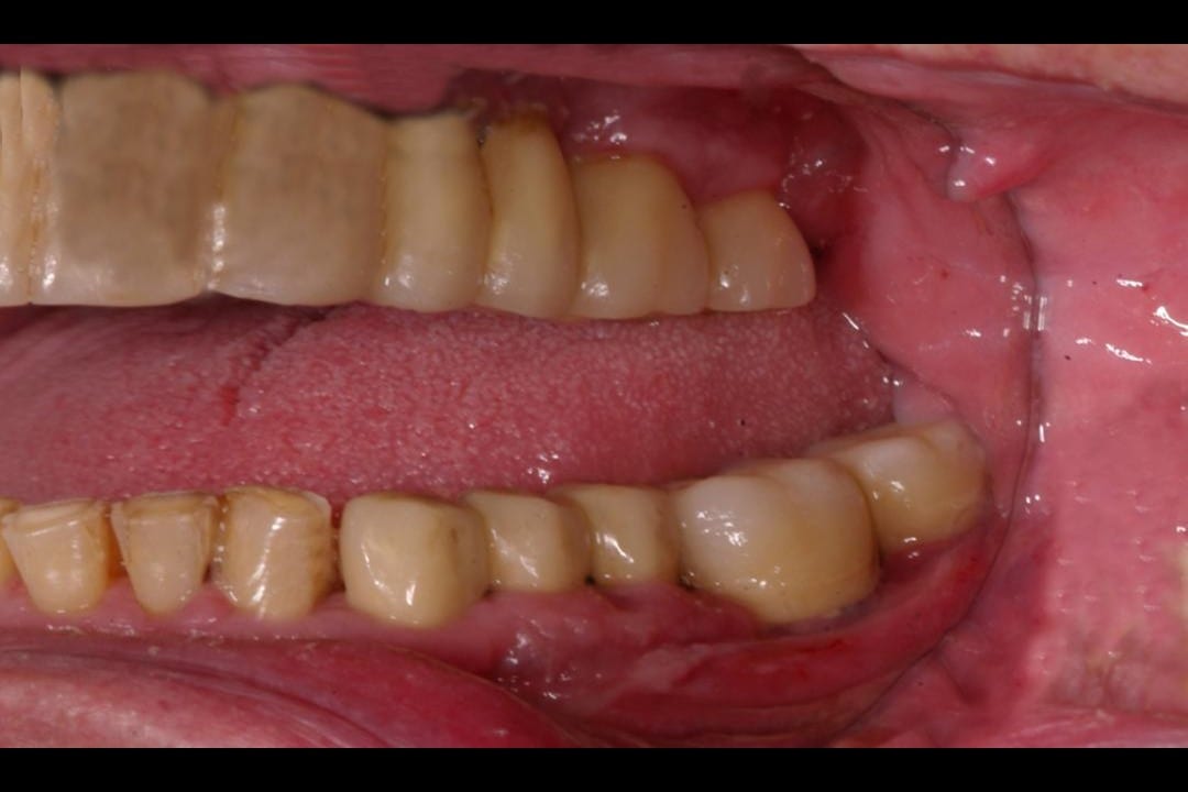 Dental Health Courses & Lectures Dental Health in Implantology