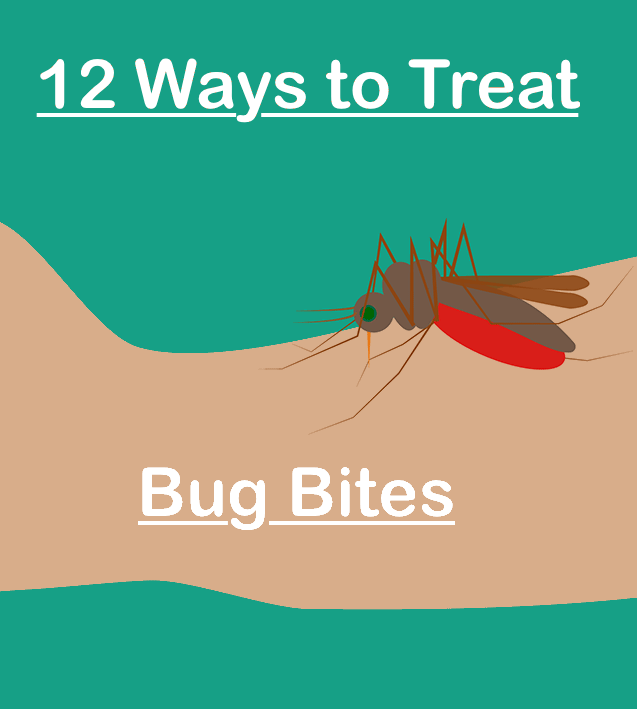 12 ways to treat bug bites Stuart Says by Stuart Brazell
