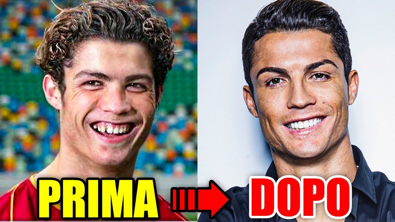 I Nostri Post Studio Dentistico Cavaliere